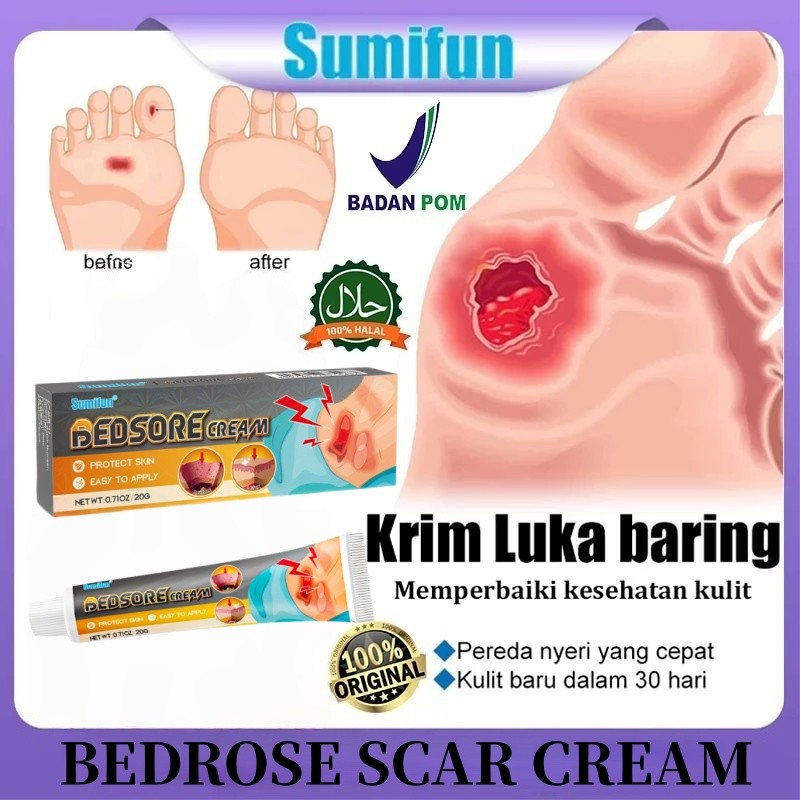 Krim Luka Baring 20g Penyembuhan Luka Luka Diabete Skrim Dekubitus Mengobati Dekubitus,