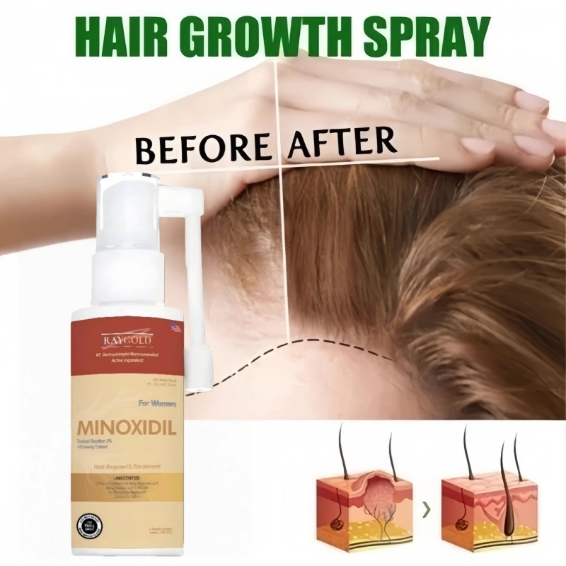 MINOXIDIL 2%for WOMEN penumbuh rambut with Ginseng extract 60ml - RAYGOLD - MINOX MINOKSIDIL anti ro