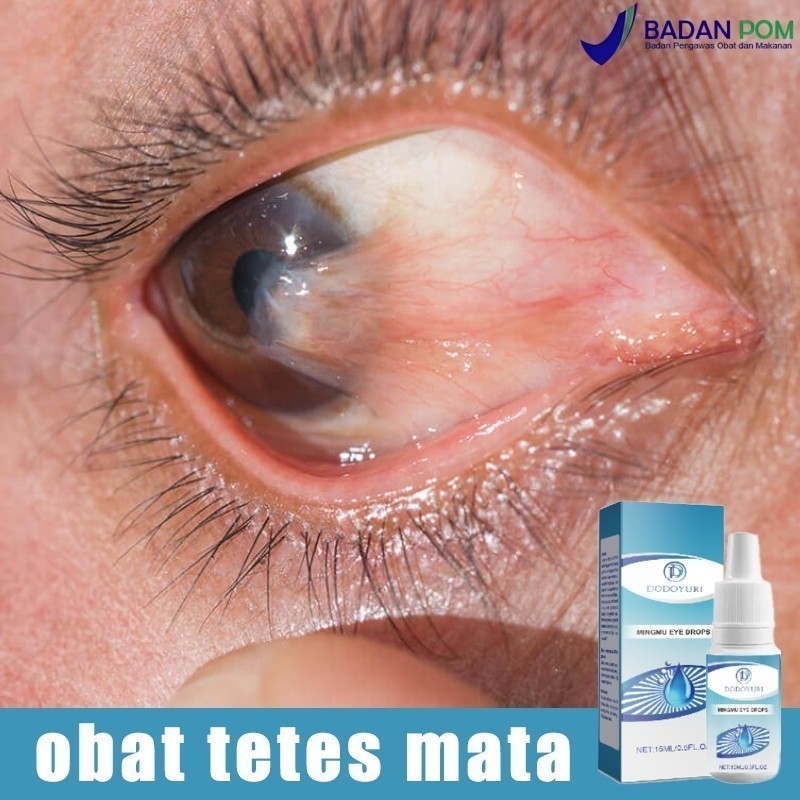 MADU EYEBOST - Obat tetes mata Obat mata minus Obat mata katarak 11ml Tetes mata eyebost Obat mata  