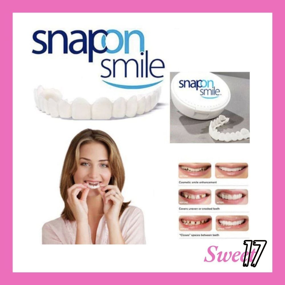 Snap on Smile - Gigi Palsu 1 Set Atas Bawah Snap On Smile