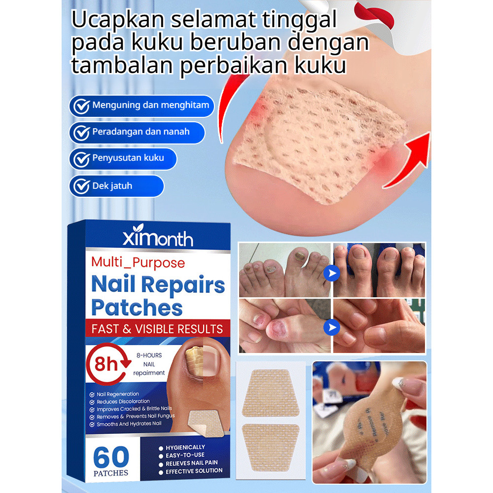 Nutrisi Intensif & Perbaikan Cepat  Koyo Perawatan Kuku Tangan dan Kaki Perawatan Kuku/Perbaikan Kuk