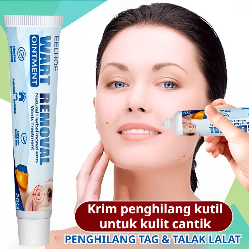 Krim Penghilang Kutil Efektif - Obat Kutil/Krim Kutil/Salep Penghilang Kutil/Kutil di Wajah/Kutil di