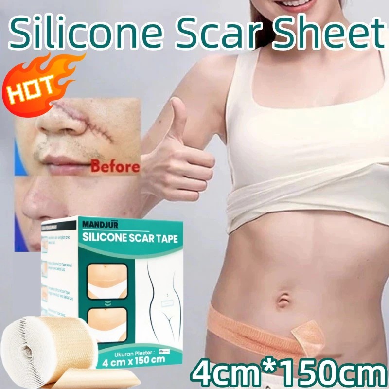 silicone scar sheet penghilang bekas luka menghilangkan bekas luka di kaki penghilang keloid menonjo