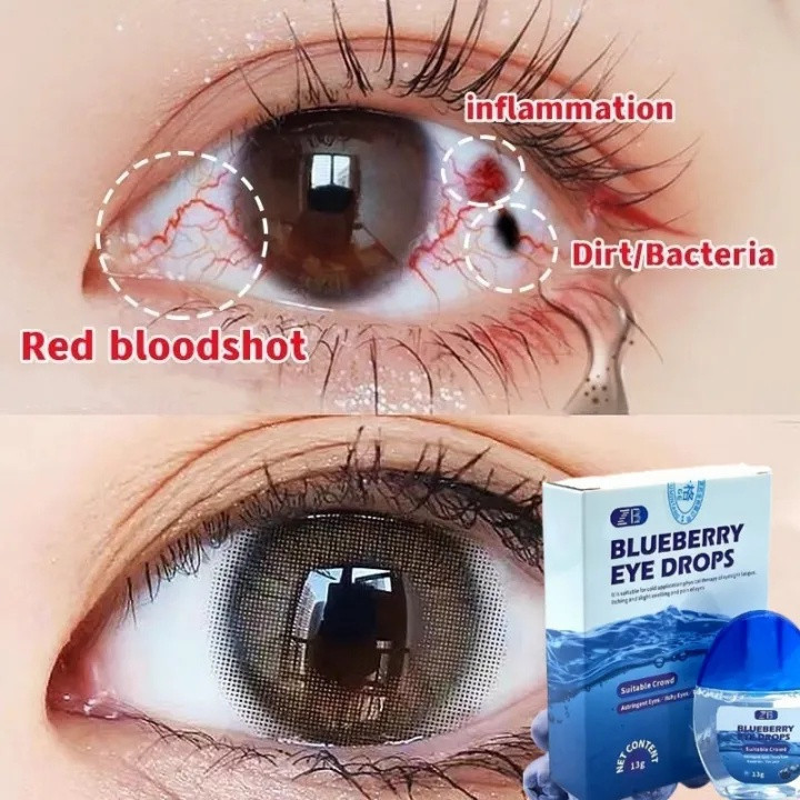 COD Obat Tetes Mata 15ml Penurun Minus Katarak Silinder Mata Aman Alami Efektif