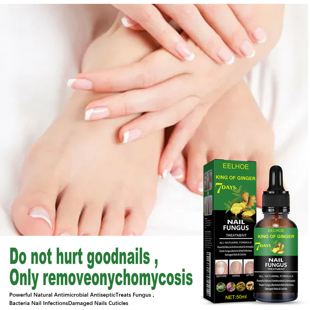 EELHO Serum Kuku Jamur Dan Rusak 50ml Serum Kuku Rusak Kunyit  Vitamin Kuku  Perawatan Kuku Berjamur