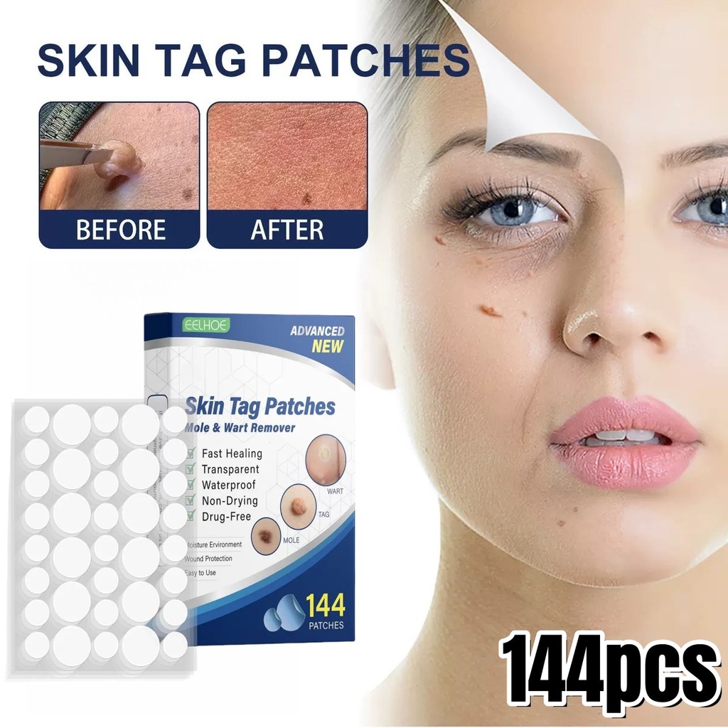 EELHOE Penghilang Kutil Patches Skin Tag Patches Wart Corn Patch Anti-wart Penghilang Tahi Lalat