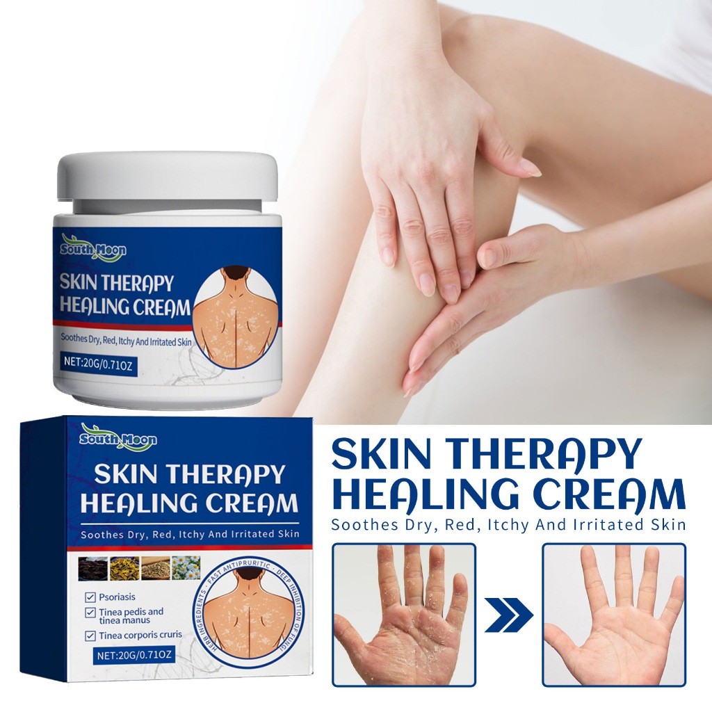 Salep Psoriasis Skin Therapy Healing Cream Anti Itchy Obat Eksim Salep