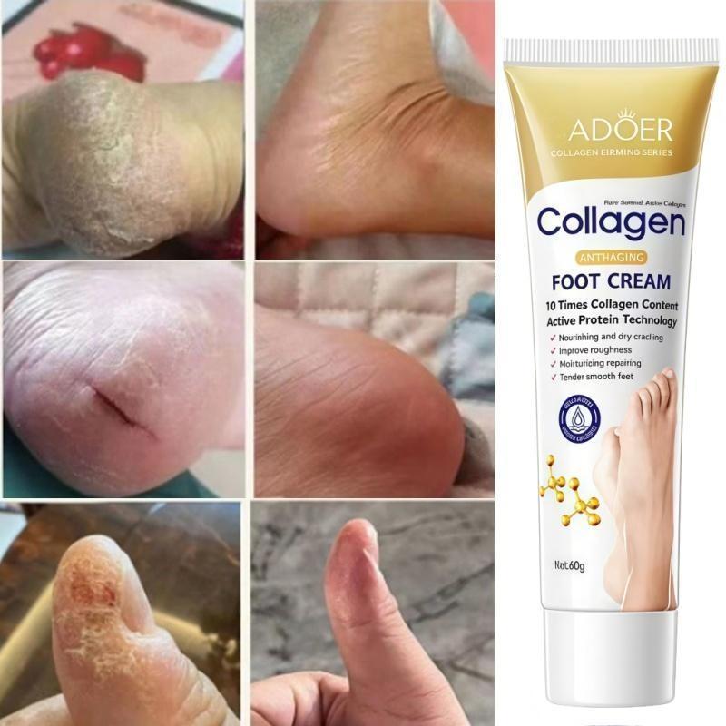 COD SADOER Krim Kaki 60g Foot Cream Obat Kaki Pecah Kering Pelembab Kaki Kasar Pecah Belah
