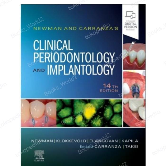 Promo Buku Newman and Carranza's Clinical Periodontology and Implantology