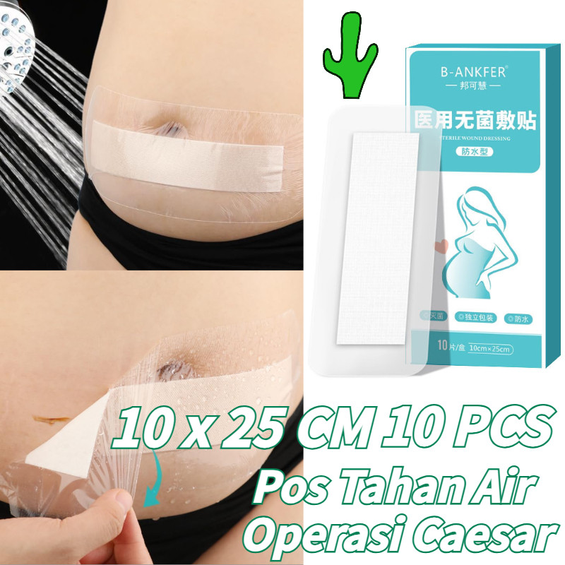 10PCS 10 x 25 CM Operasi Caesar Plester Luka Cesar Plaster Pasca Operasi Sesar Plester Putih Perekat