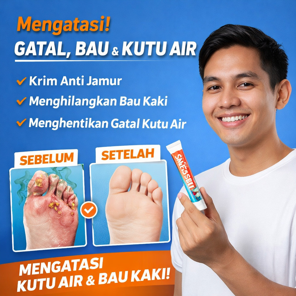 [Anti Gatal & Jamur Instan] Foot Care Kaki Bau & Gatal / Krim Jamur Kaki / Krim Anti Gatal / Lotion 