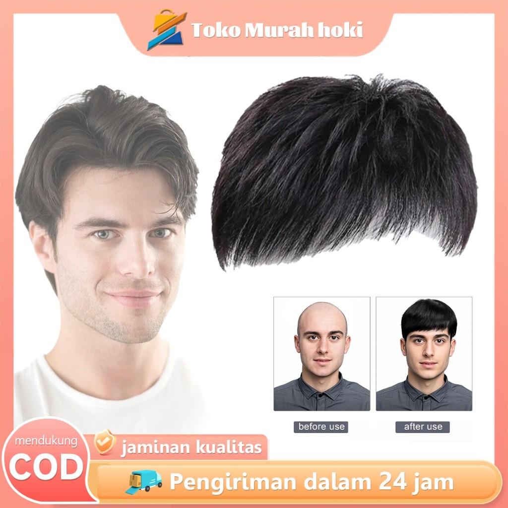 Penutup Botak Sebagian Hairtop Pria Rambut Palsu Pria Tutup Botak Dahi Depan Rambut Simulasi Pria