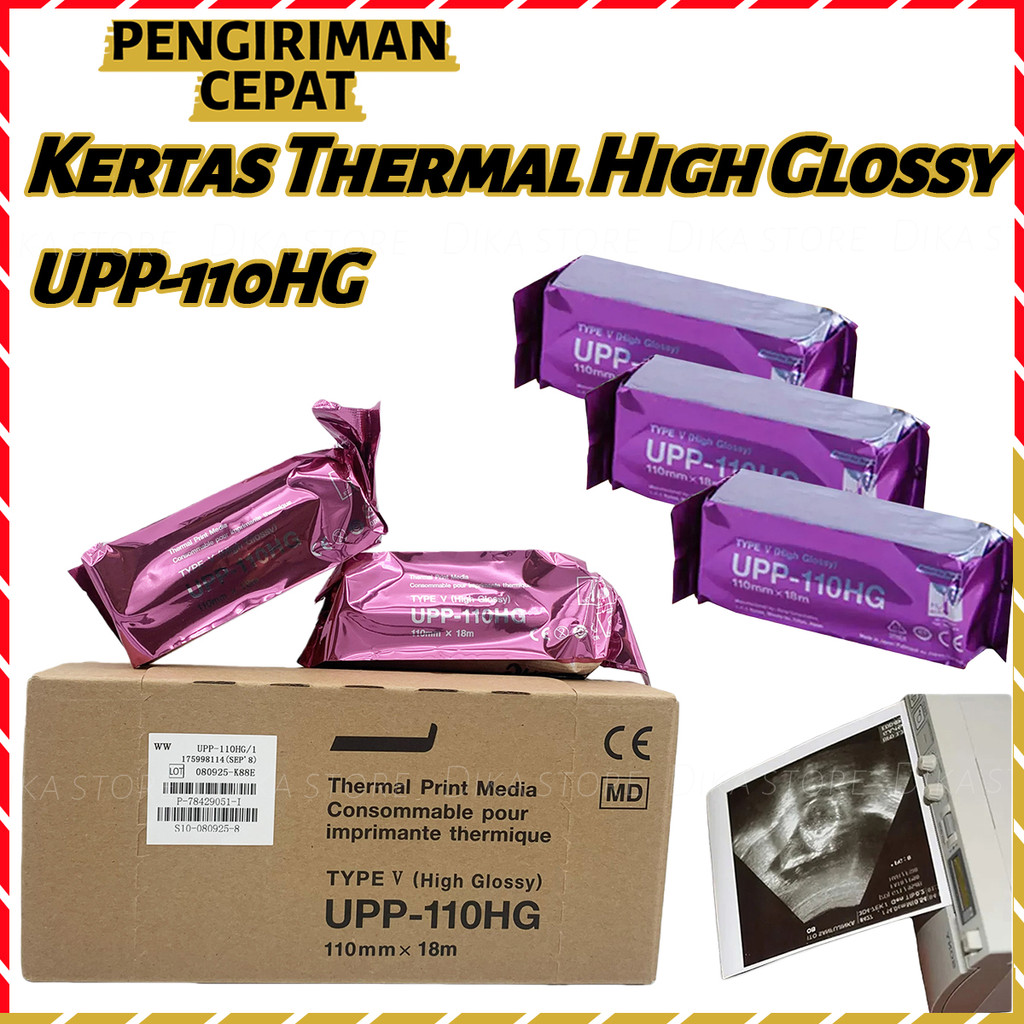 1 Pc Kertas USG Sony UPP-110HG / 110S Kertas Thermal High Glossy Jernih Tahan Lama Tidak Mudah Luntu
