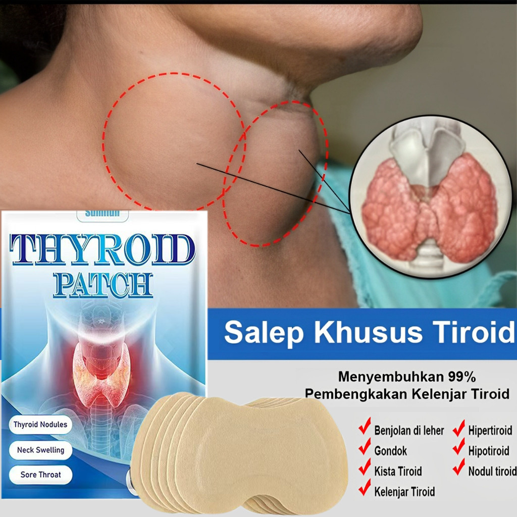 plester obat tiroid Salep Tiroid Obat benjolan di leher Obat Gondok Obat Kelenjar Tiroid Gondok Bera