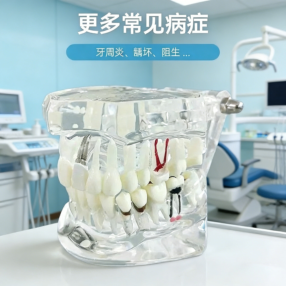 Model gigi dental study model phantom gigi bisa di lepas transparan model study gigi edukasi transpa