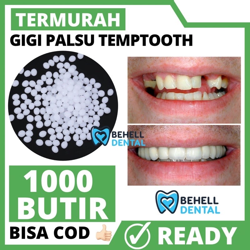 TERMURAH  1000 BUTIR TEMPTOOTH GIGI PALSU SEMENTARA PENAMBAL GIGI PATAH RENGGANG / TEMTOOTH / BAHAN 