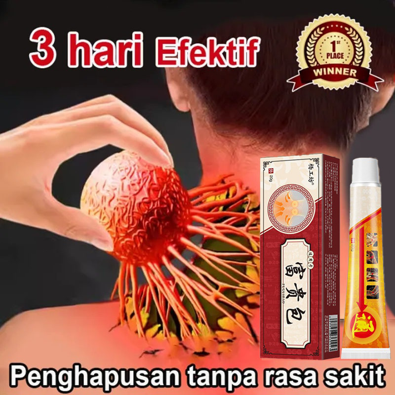 Obat benjolan obat lipoma obat benjolan di leher salep benjolan Obat Benjolan lipoma obat benjolan p