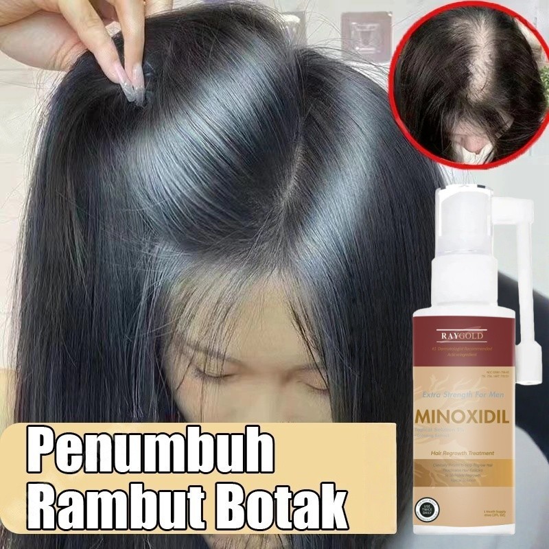 100% Hair Growth Serum Minoxidil 5% Pertumbuhan Rambut Cepat 60ml Rambut Rontok Hair Serum Penumbuh 