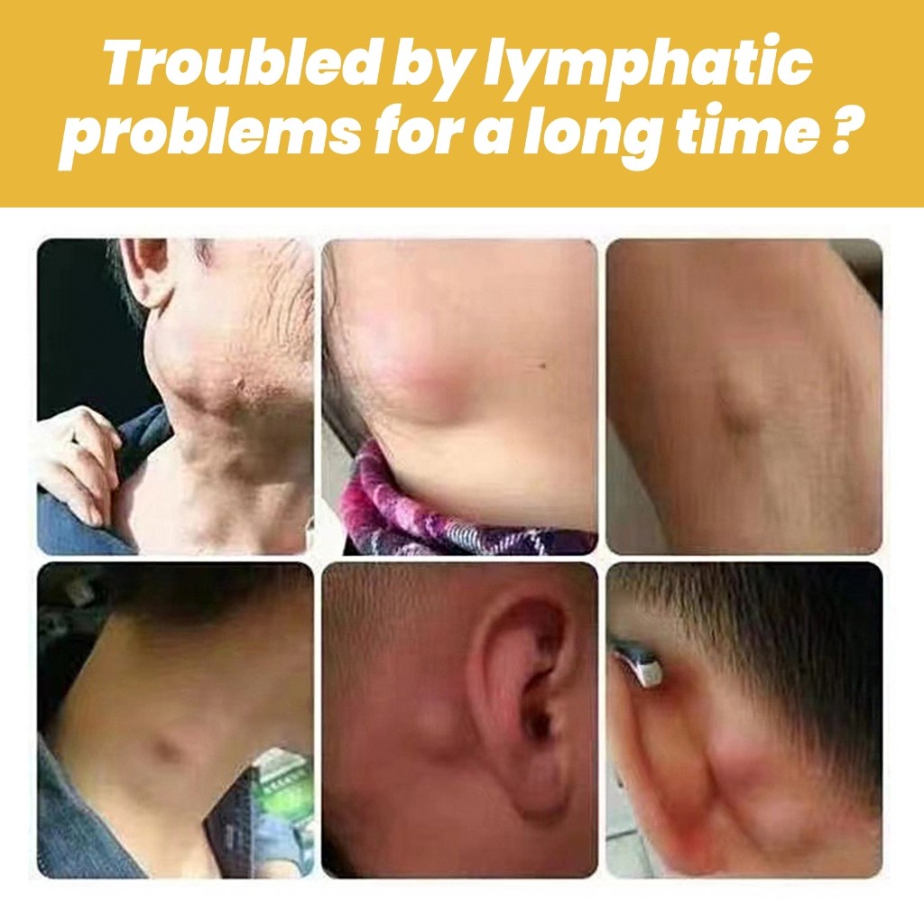 Ximonth Lymph Node Seulpting Drainage Soothe Cream 20g Krim Penenang Limfatik Menghilangkan Benjolan