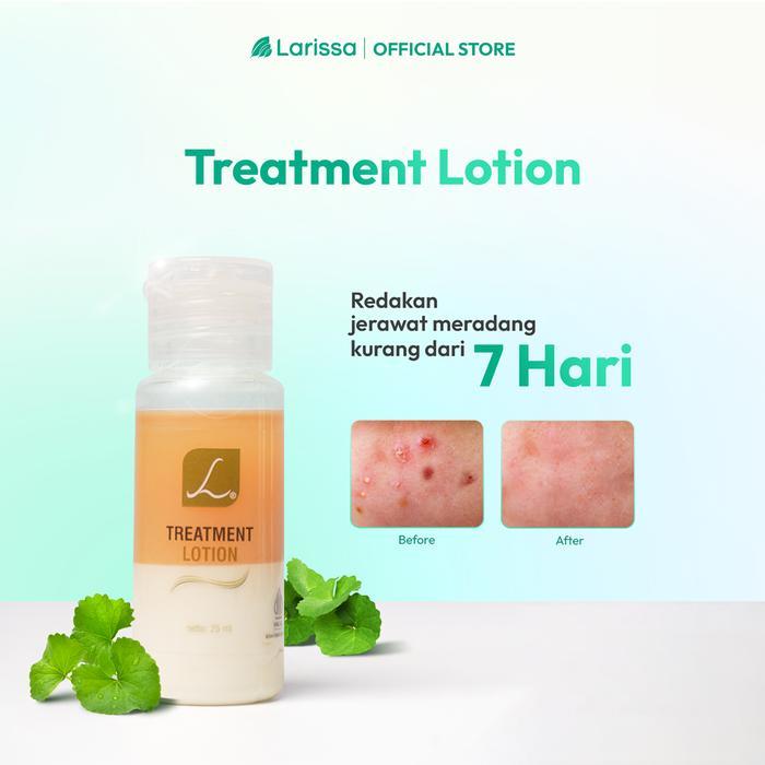 Larissa Treatment Lotion / Acne Spot ( Perawatan  Muka  Berminyak  Berjerawat  Meradang)