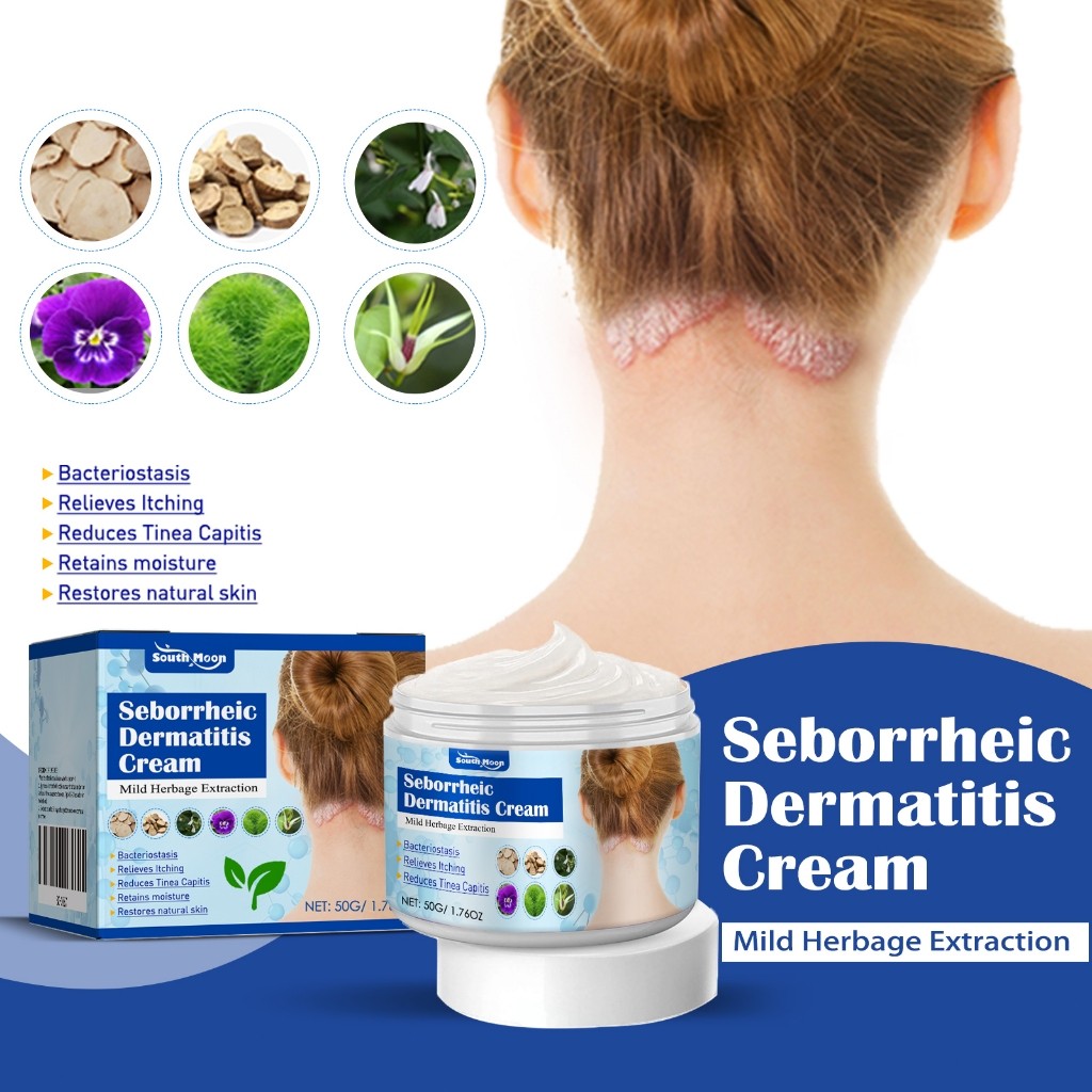 South Moon Seborrheic Dermatitis Cream 50g Krim Kulit Gatal Obat Kulit Kepala Psoriasis Dermatitis S