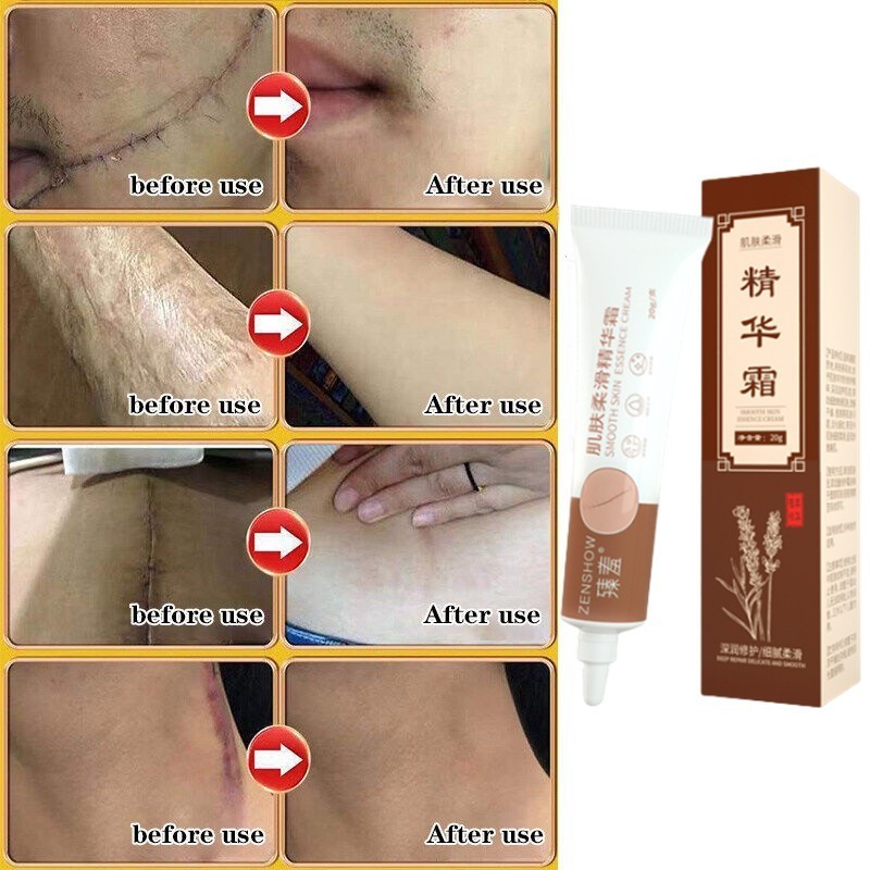 COD Penghilang Bekas Luka Bayi Anak Krim Kaki Hitam Koreng Menghilangkan Bekas Luka Wajah Penghilang