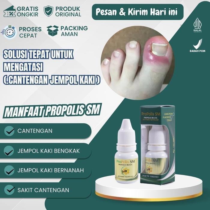 (Salsa Beauty Shop) Propolis SM untuk Kuku Cantengan Jempol Kaki Bengkak Nyeri Bernanah Bau - Propol