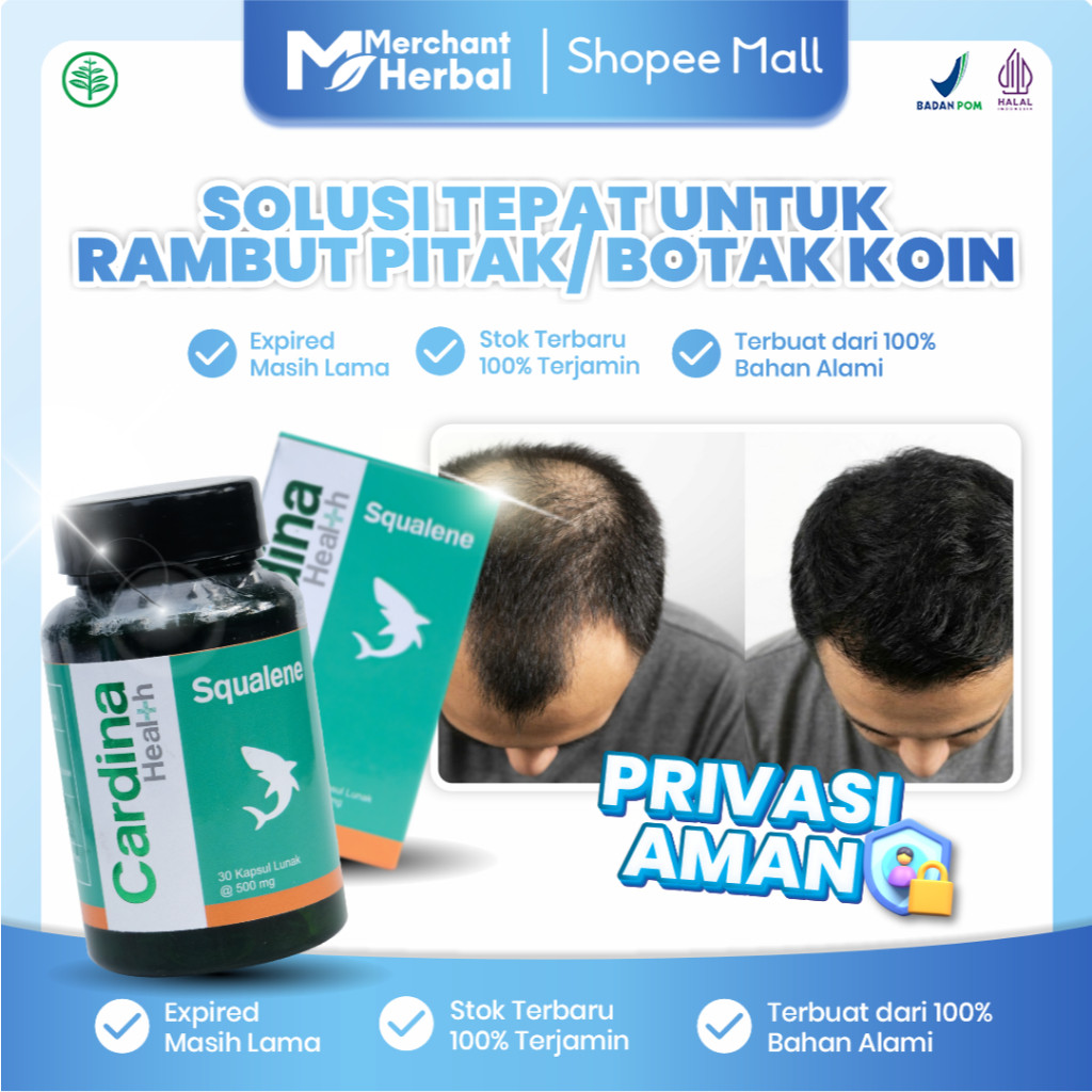 Cardina Squalene - Obat Rambut Pitak Alopecia Areata, Rambut Botak Koin, Obat Penumbuh Rambut Botak,