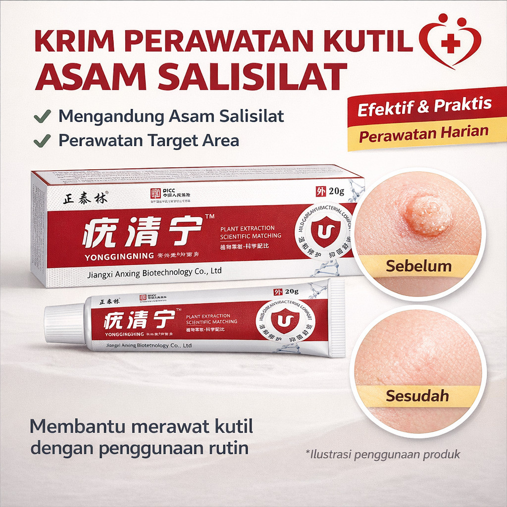 24 jam pengiriman / Salep Penghilang Kutil Asam Salisilat / Salep Anti Bakteri Penghilang Kutil / Me