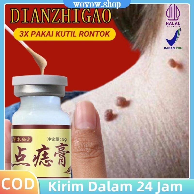 Krim Penghilang Kutil Krim Penghilang Tahi Lalat Di Wajah Obat Untuk Mengatasi Kutil Dan Tahi Lalat