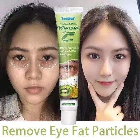 Krim Penghilang Milia 20g Krim Mata Agen Penghilang Milia Obat Milia untuk Bawah Mata Krim Milia Pen