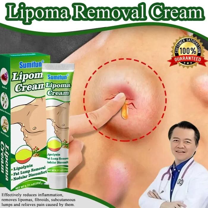 lipoma cream salep benjolan 100% Original Herbal Ampuh lipoma cream salep benjolan 7 days lipoma rem