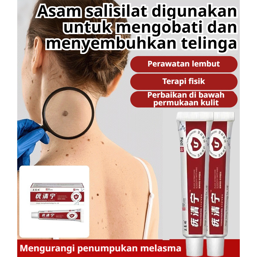 [Promo Spesial] Salep Kutil & Krim Penghilang Kutil | Salep Asam Salisilat Antibakteri | Salep Peraw