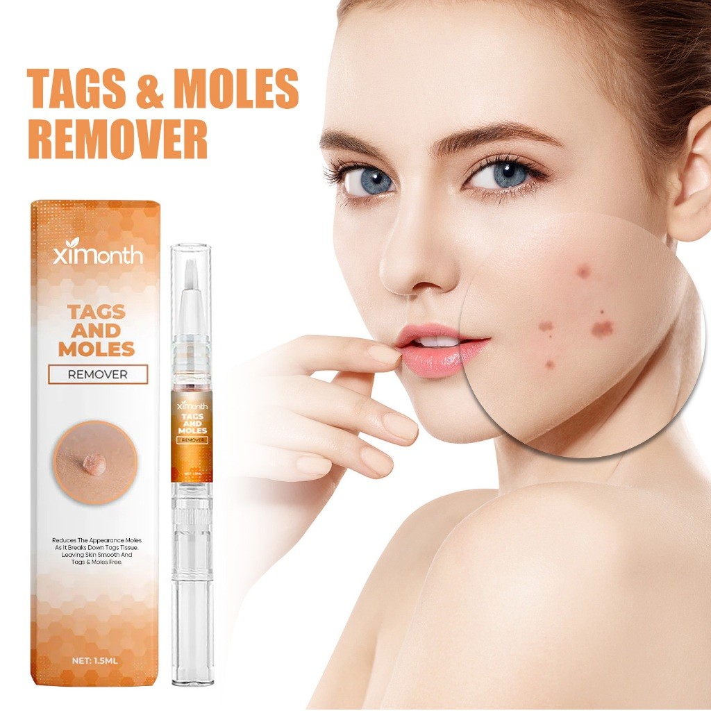 Ximonth Wart Skin Tag Removal Pen