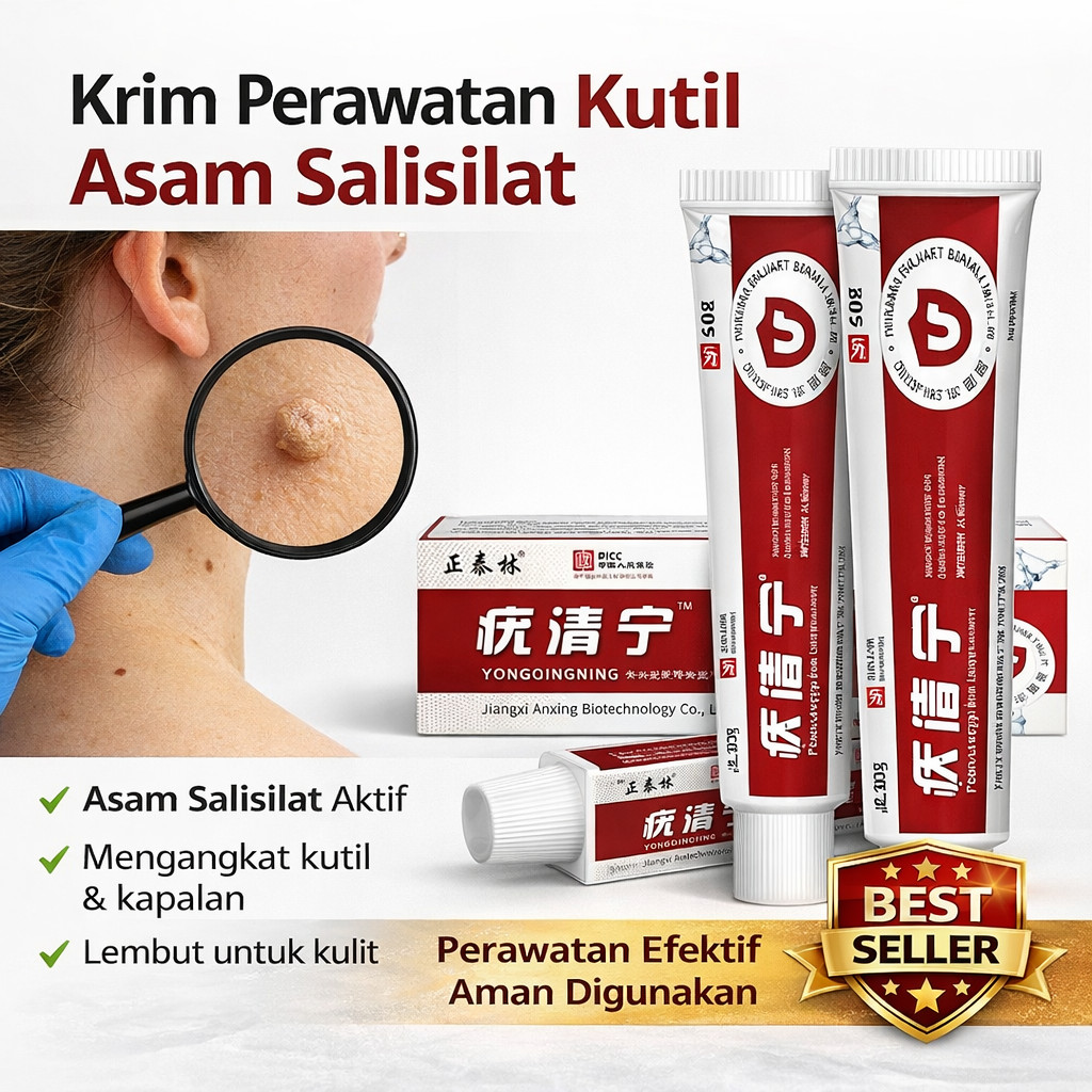 Krim Perawatan Kutil Asam Salisilat / Salep Penghilang Kutil Kapalan / Obat Topikal Untuk Kutil Viru