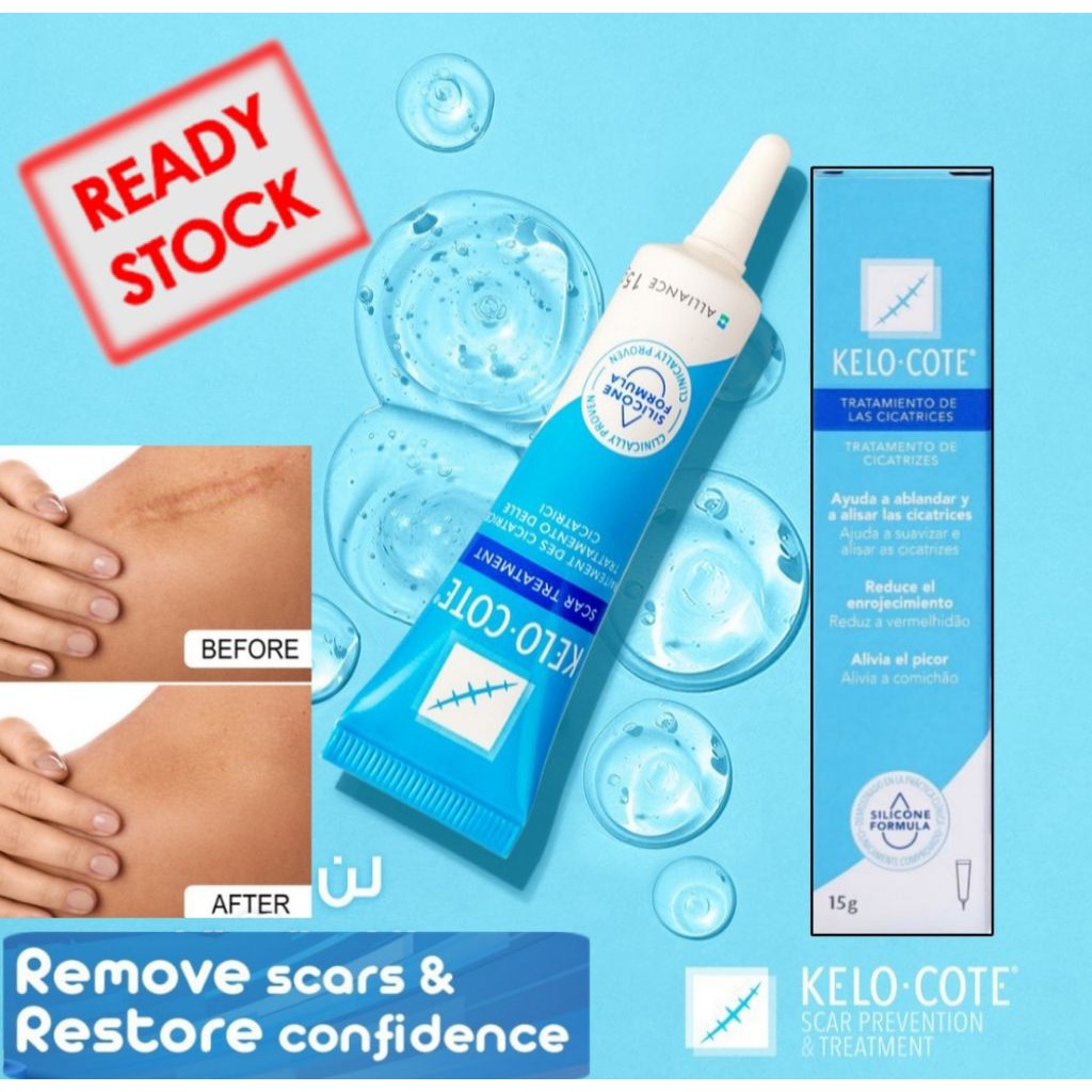 KELO COTE GEL 15 GR Perawatan Penghilang Bekas Luka Keloid sayatan Bekas Operasi  Kelocote KELO COTE