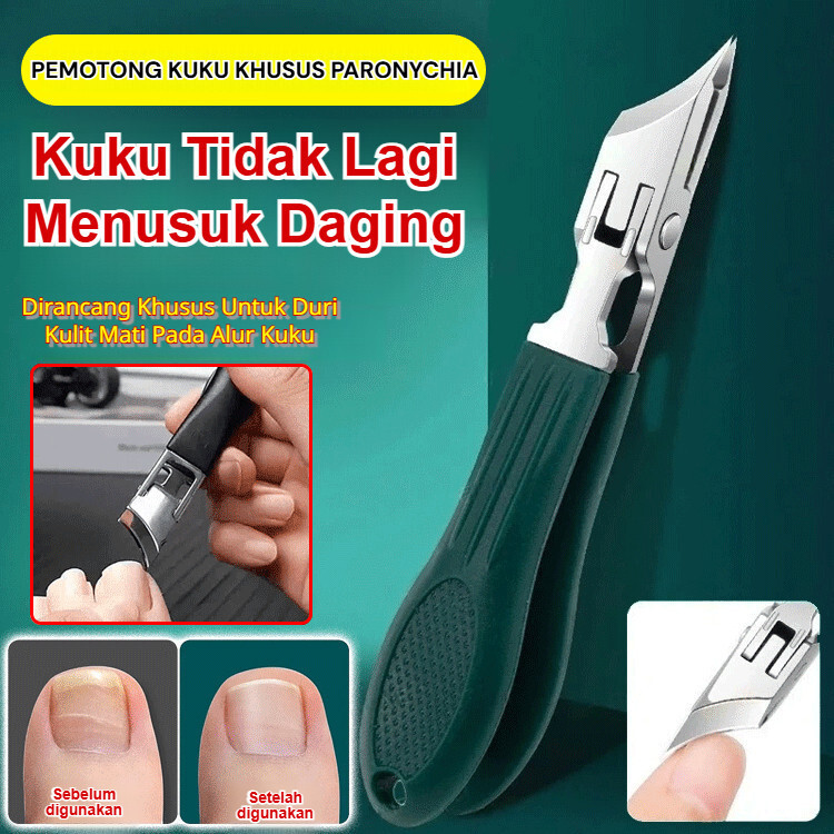 [Diskon Spesial Hari Ini] gunting kuku khusus cantengan | alat perawatan kuku kaki | pisau miring st