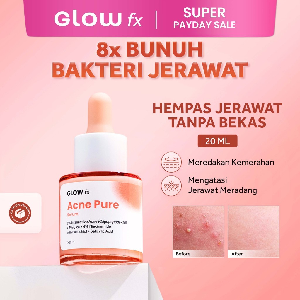 GLOW fx BEAUTY Acne Pure Serum 20mL