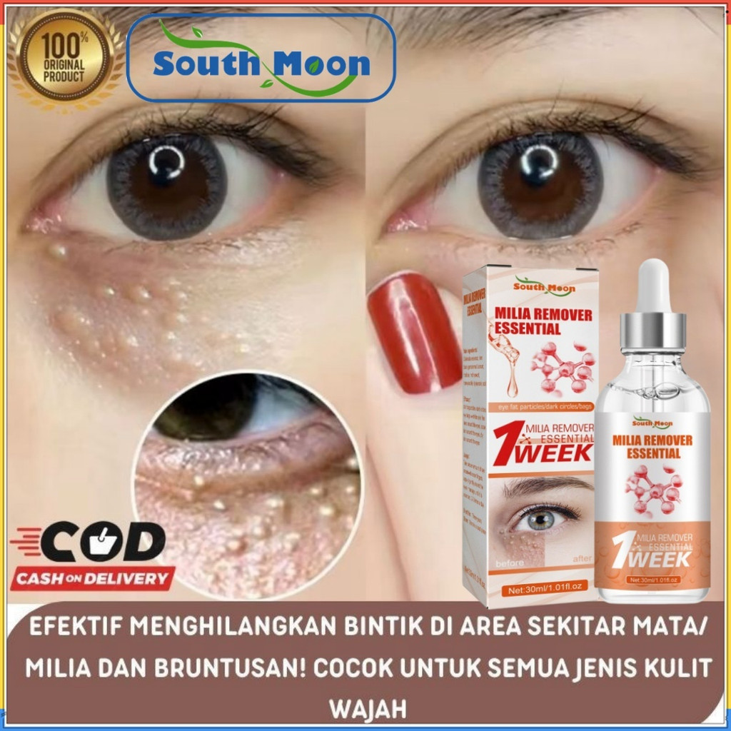 Milia remover serum penghilang perontok milia bintik putih mata Milia Remover Treatment Skin Essence