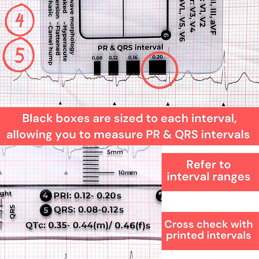 Penggaris EKG 7 Step Transparan / ECG Ruler Portabel Presisi Tinggi / Alat Ukur Detak Jantung Untuk