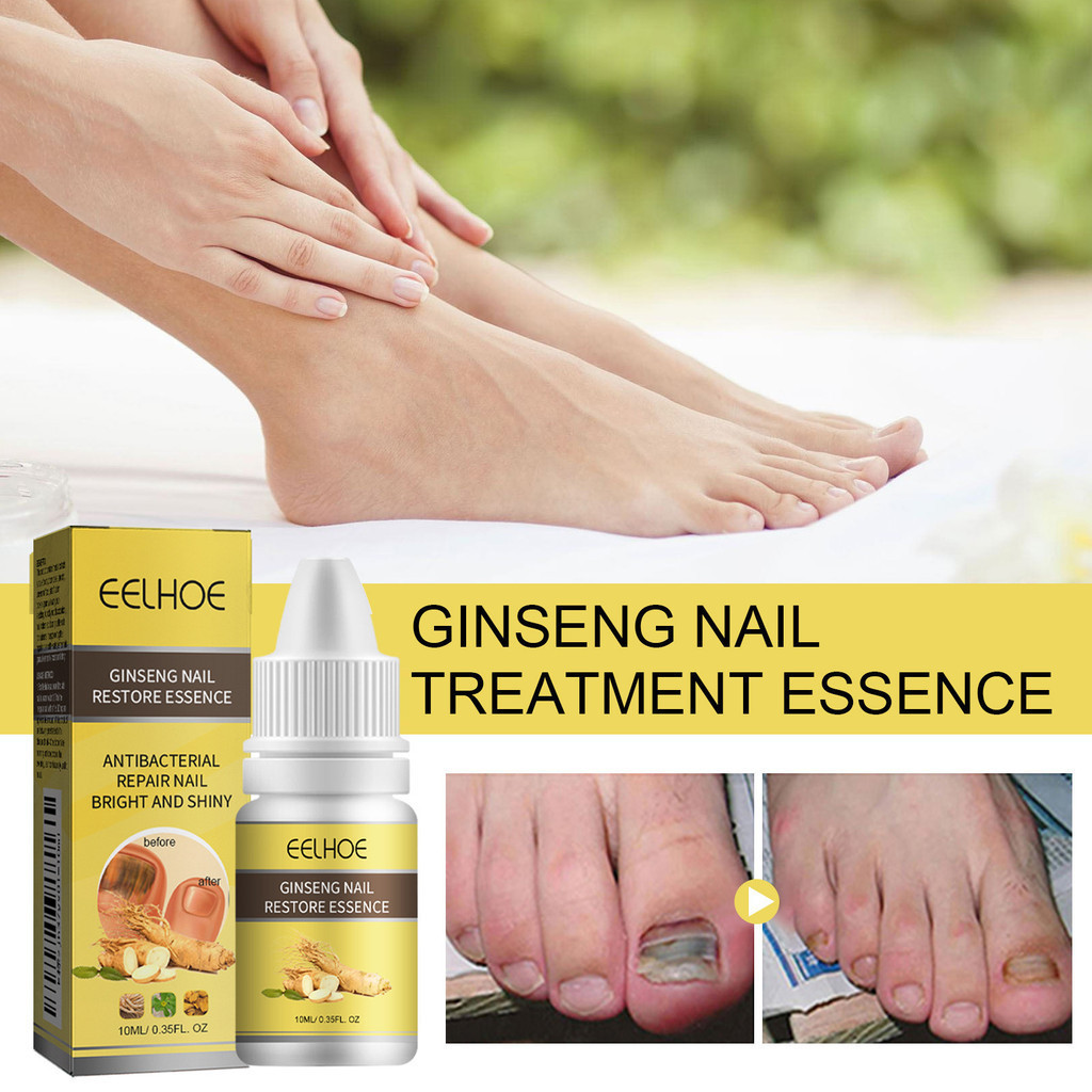EELHOE Ginseng Nail Treatment Essence 10ml Obat Jamur Kuku Oedo Kuku Obat Perawatan Kesehatan Jamur 