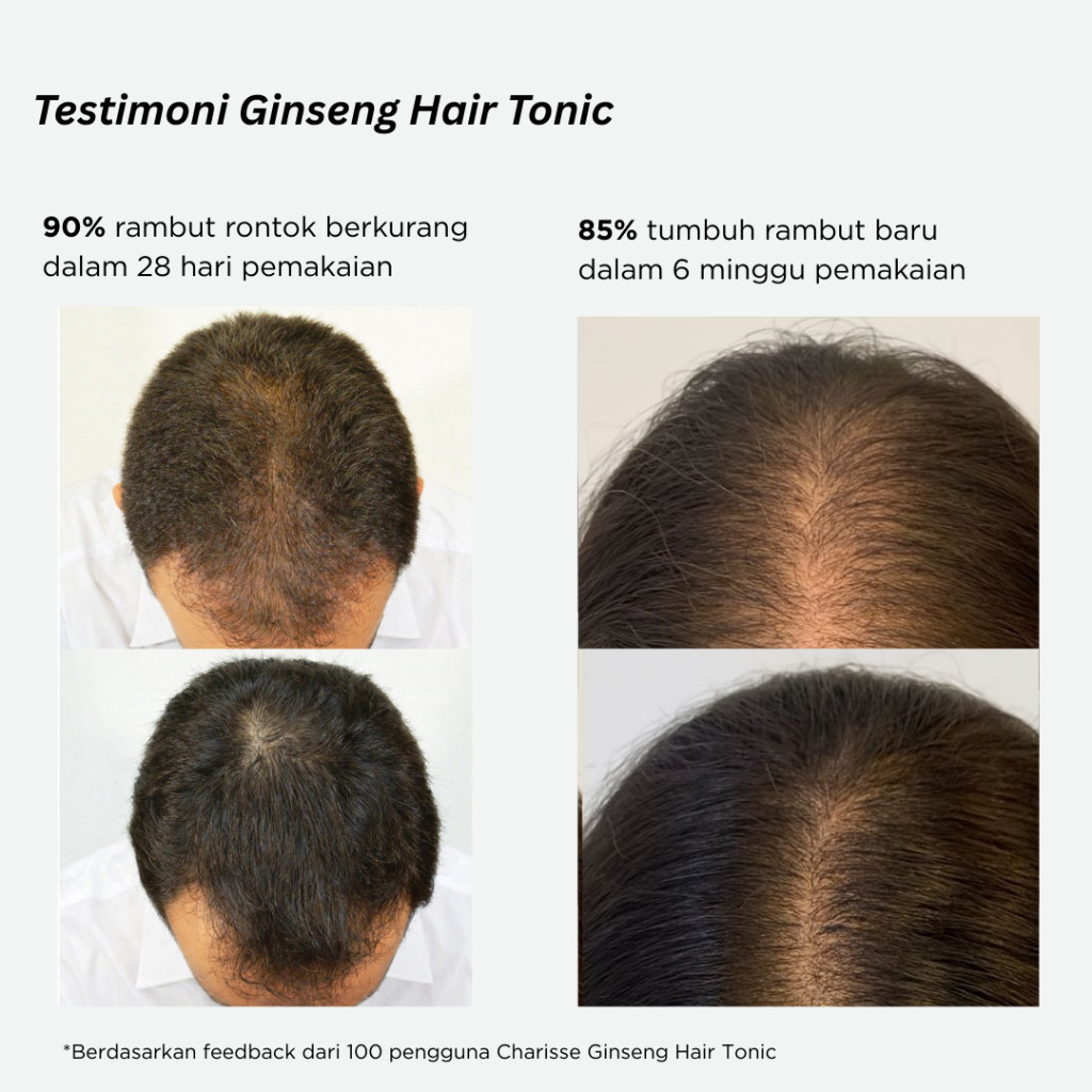 TERMURAHCHARISSE Hair Tonic Ginseng | Charisse Hair Booster | Perawatan Rambut Rontok parah | Hair T