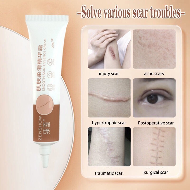 COD Penghilang Bekas Luka Bayi Anak Krim Kaki Hitam Koreng Menghilangkan Bekas Luka Wajah Penghilang