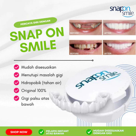 Gigi Palsu Lepas Pasang Untuk Gigi Ompong Snap On Smile