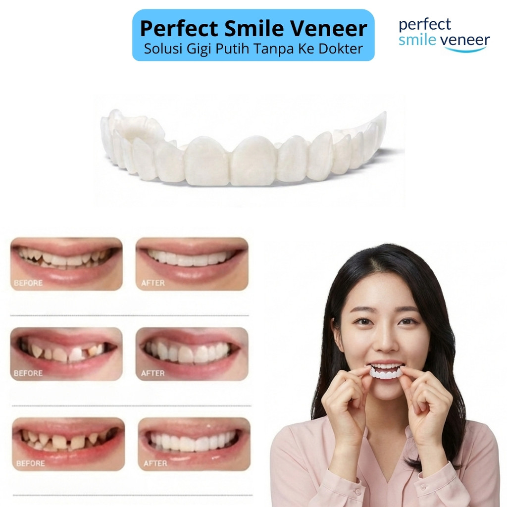 Perfect Smile Veneer | Veneer Gigi Instan Snap-On | Cover Gigi Kuning / Celah - XX150