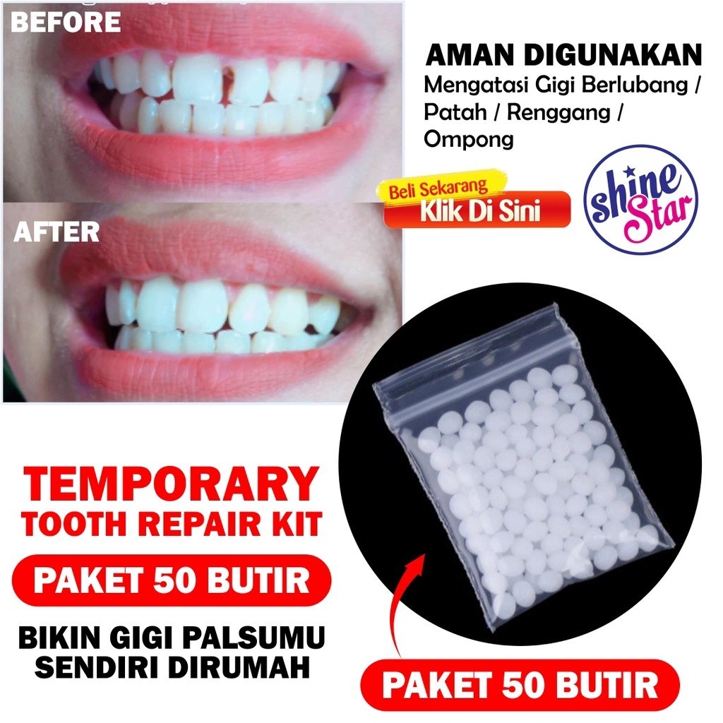 STAR+ SHINE STAR - [PAKET ISI 50BUTIR] GIGI PALSU SEMENTARA PENAMBAL RENGGANG PATAH DLL TEMPORARY TO