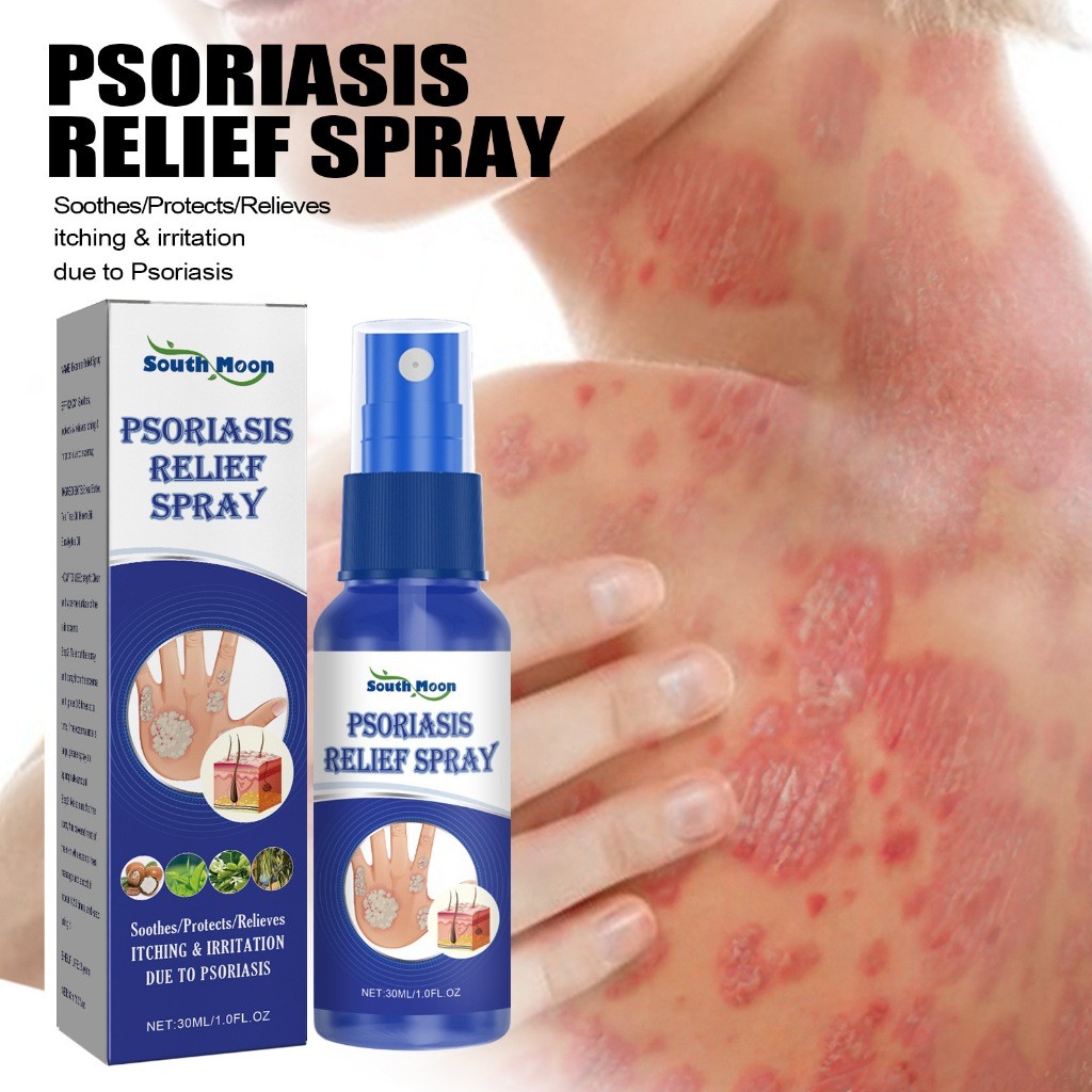 PSoriasis Relief Spray Spray Kulit Jamur Spray Eksim Menghambat Dermatitis Jamur