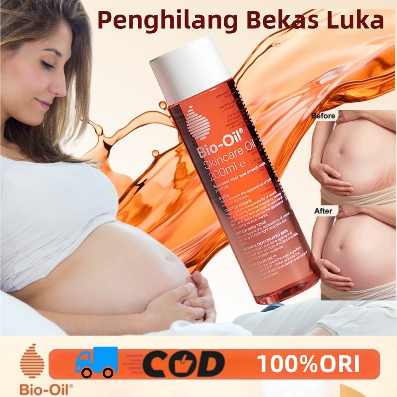 Bio Oil 200ml / Bio Oil Original 100% / Bio Oil Stretch Mark / Bio Oil Penghilang Bekas Luka