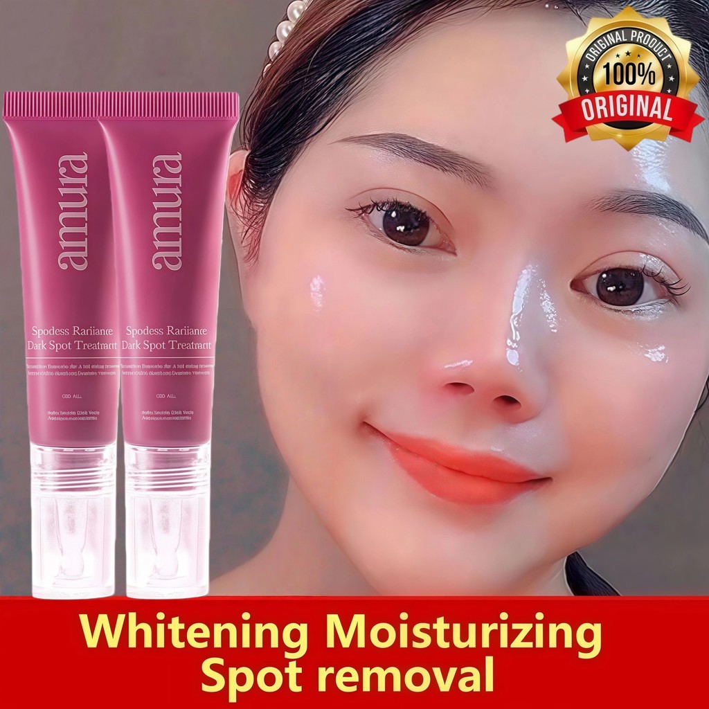 Whitening blemish Freckle Cream Remove Dark Spots Anti Freckle Cream Niacinamide Fade Pigmentation M