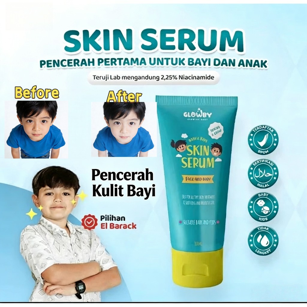 Skin Serum Anak dan Baby Lotion/Memutihkan Pencerah Kulit Bayi dan Anak 100 ml bekas gatal Penghilan